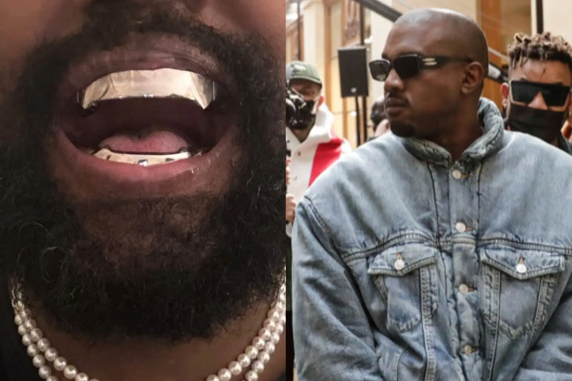 Kanye West shocks with titanium teeth worth $850,000